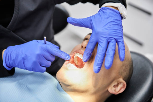 Best Emergency Wisdom Teeth Removal in Verona, WI
